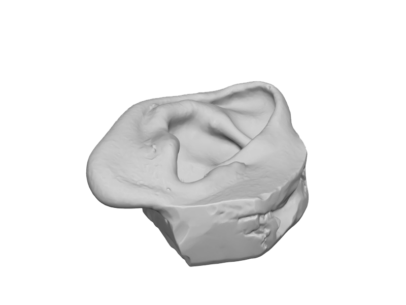 skanowanie 3d w medycynie